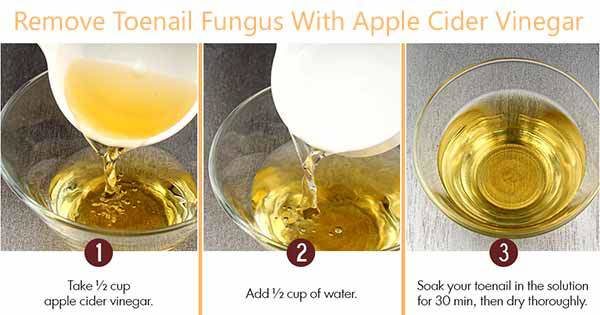 Effective Remedies Fungus Fast