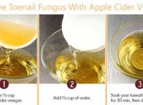 Effective Remedies Fungus Fast